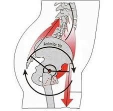 What Is Anterior Pelvic Tilt (and How ...