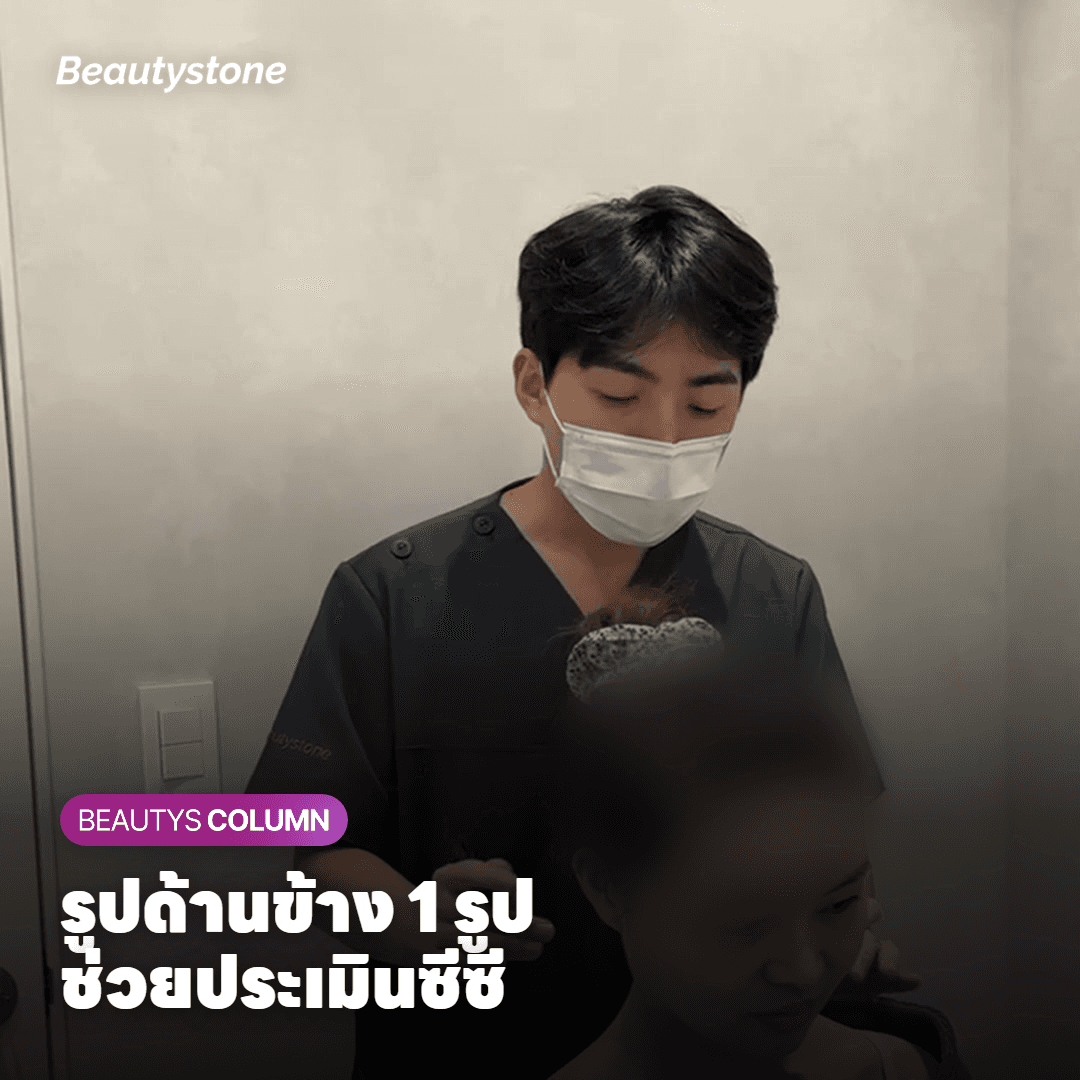 รูปด้านข้าง 1 รูป ช่วยประเมินซีซี