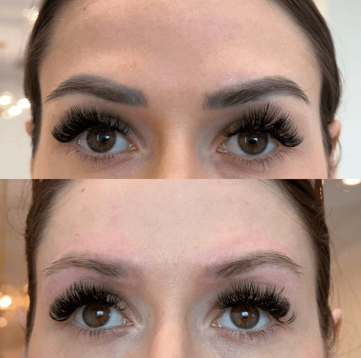 PMU & Microblading entfernen