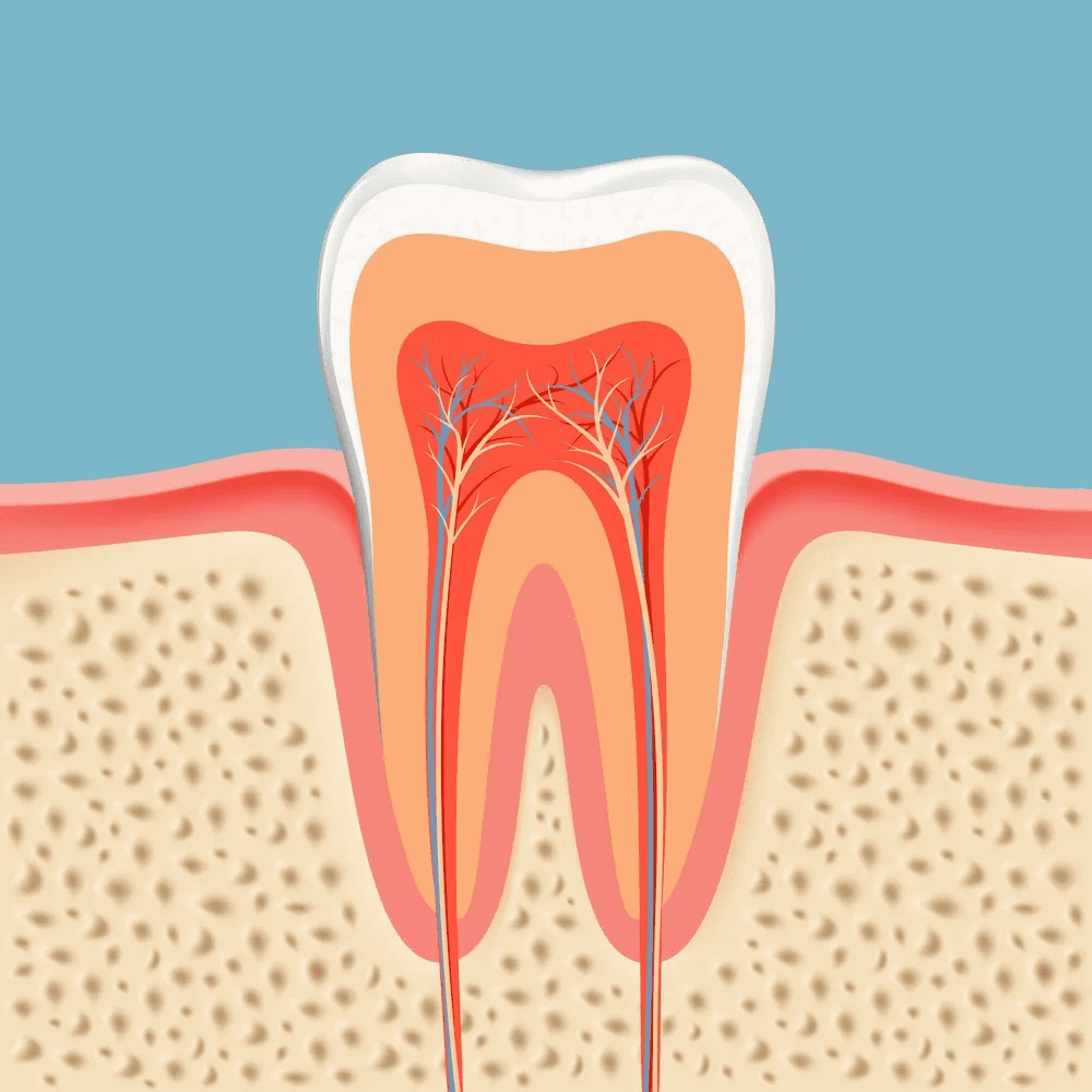 Anatomy of tooth with nerve pain requiring root canal