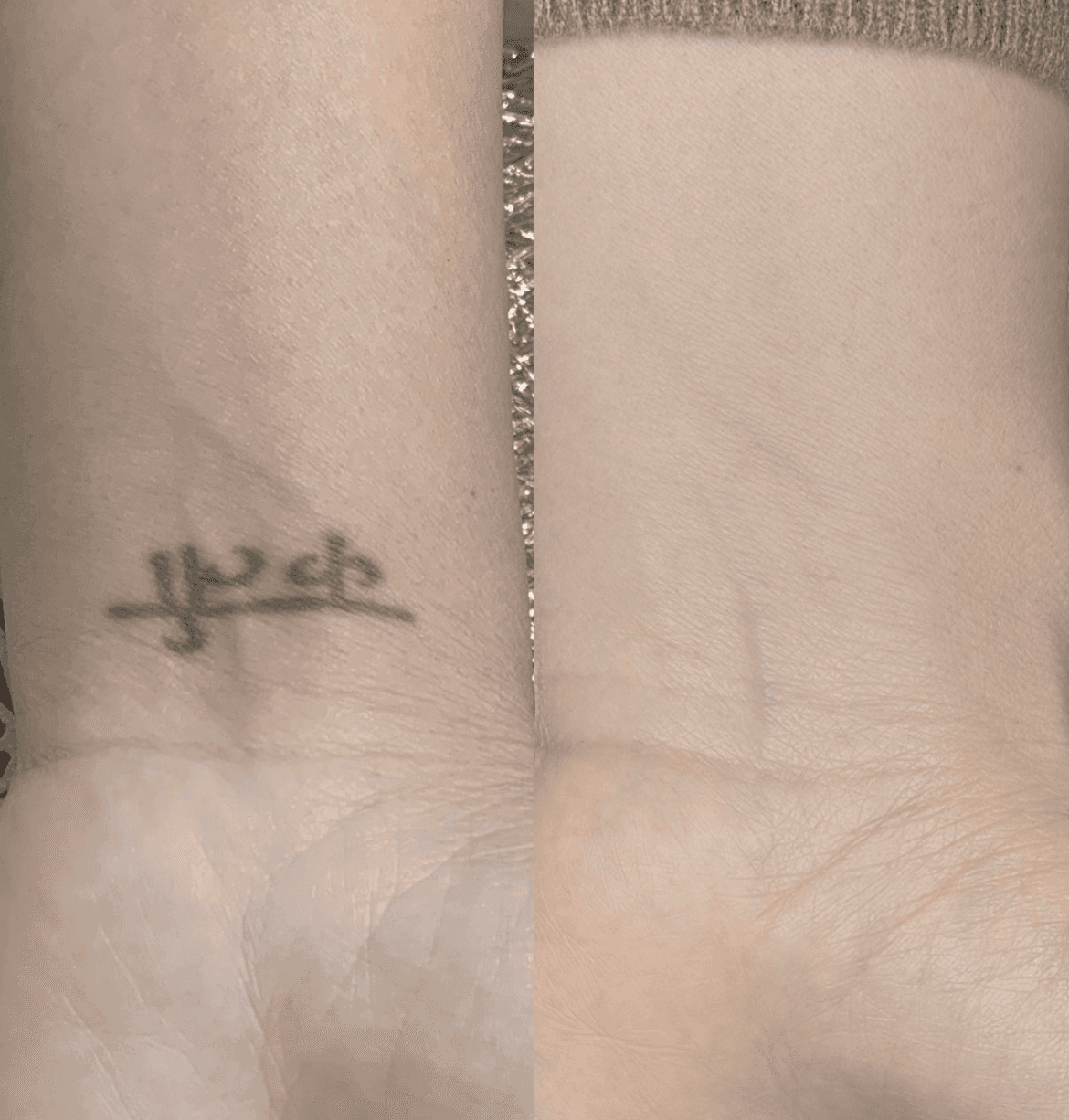 Haarpigmentierung Schweiz