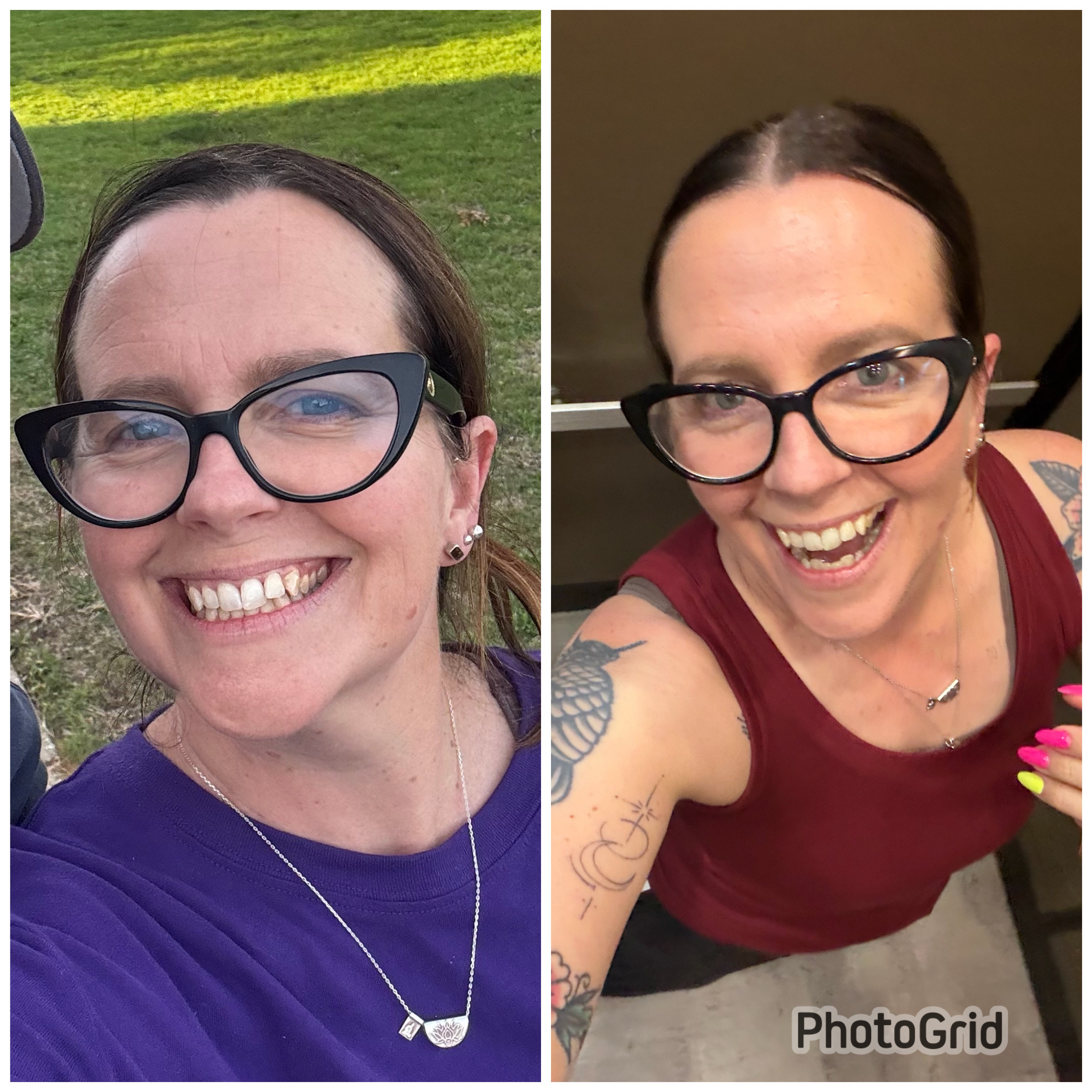 Nic before and after transformilates