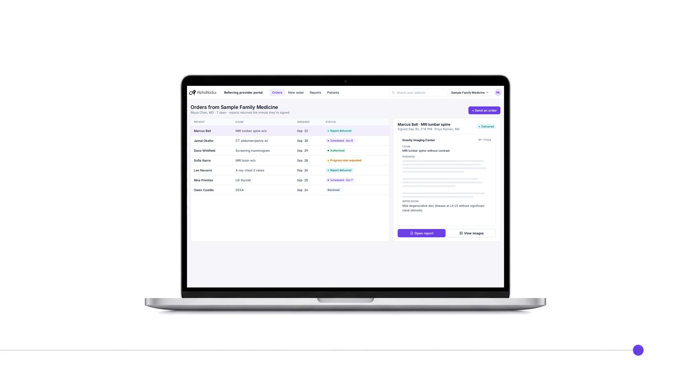The referring physician portal on a laptop: the office’s orders with each one’s status, and a signed MRI report with Open report and View images