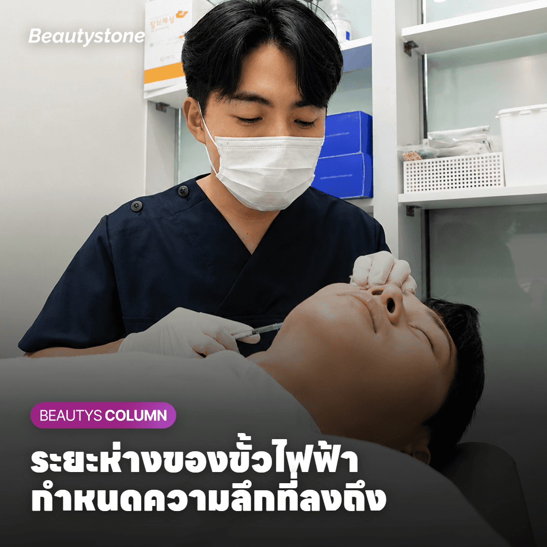 ระยะห่างของขั้วไฟฟ้ากำหนดความลึกอย่างไร