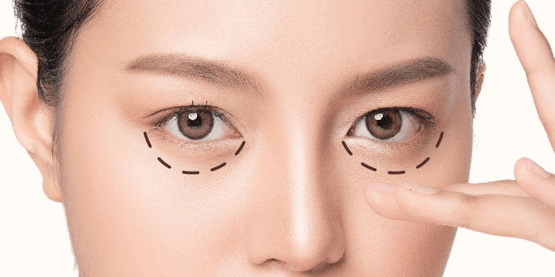 Lựa chọn giải pháp phù hợp để cải thiện gương mặt tươi trẻ, rạng rỡ
