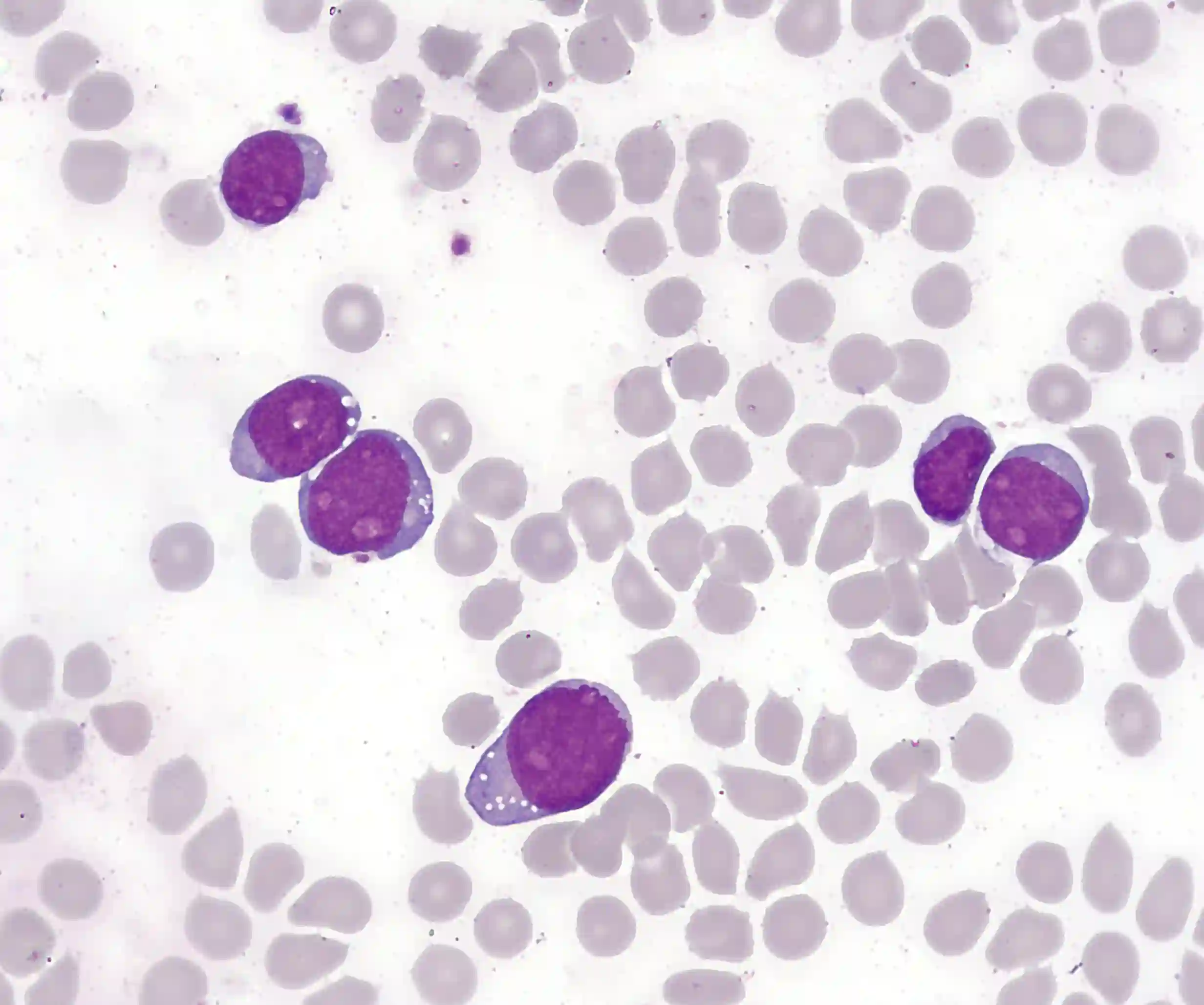 immune system