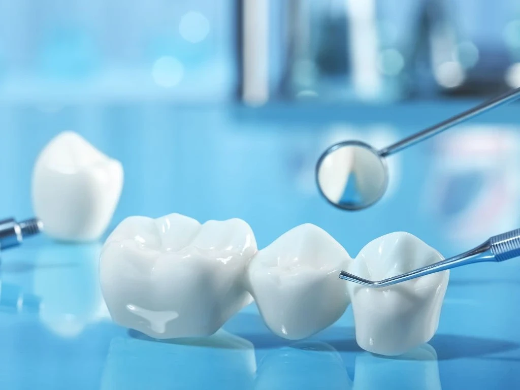 dental crowns and bridges