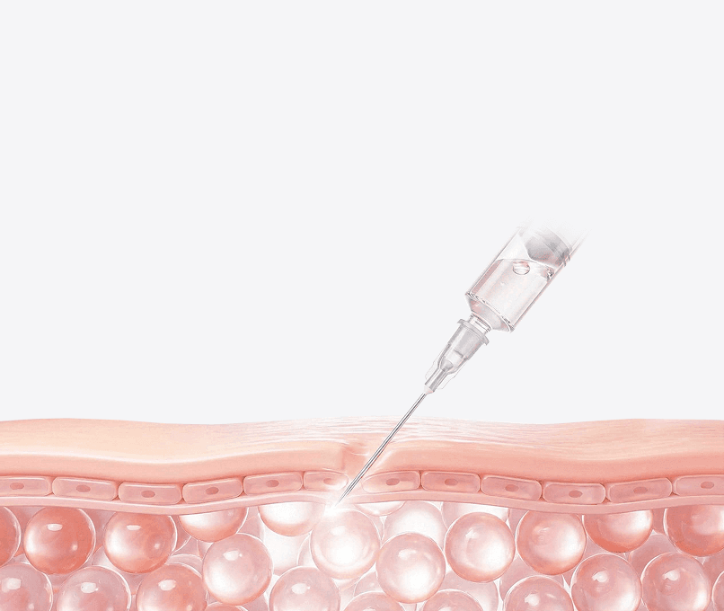 쥬베룩을 이용한 흉터의 수복 |  뷰티스톤 홍대피부과