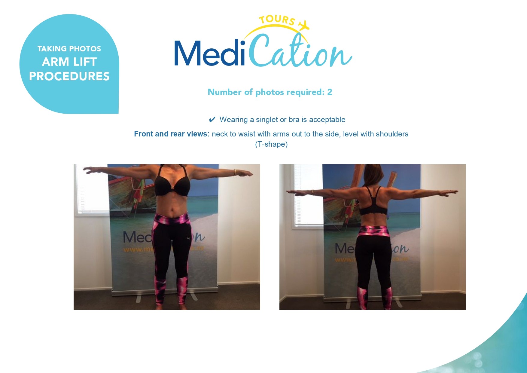 Arm lift surgery photo guide showing the required front and back poses with arms extended horizontally for surgeon assessment.