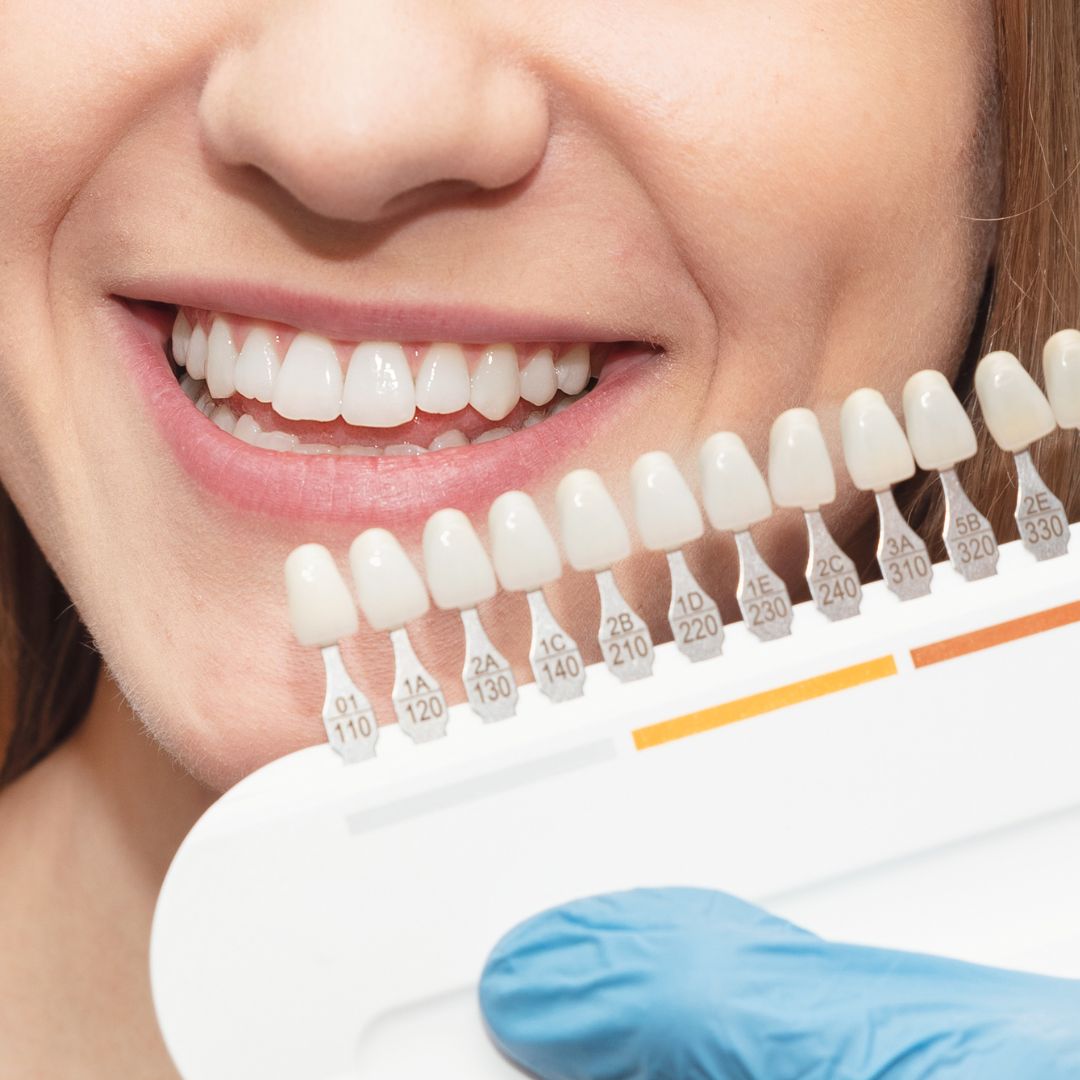 Cosmetic dentistry and smile designing at Dentistree Kolkata