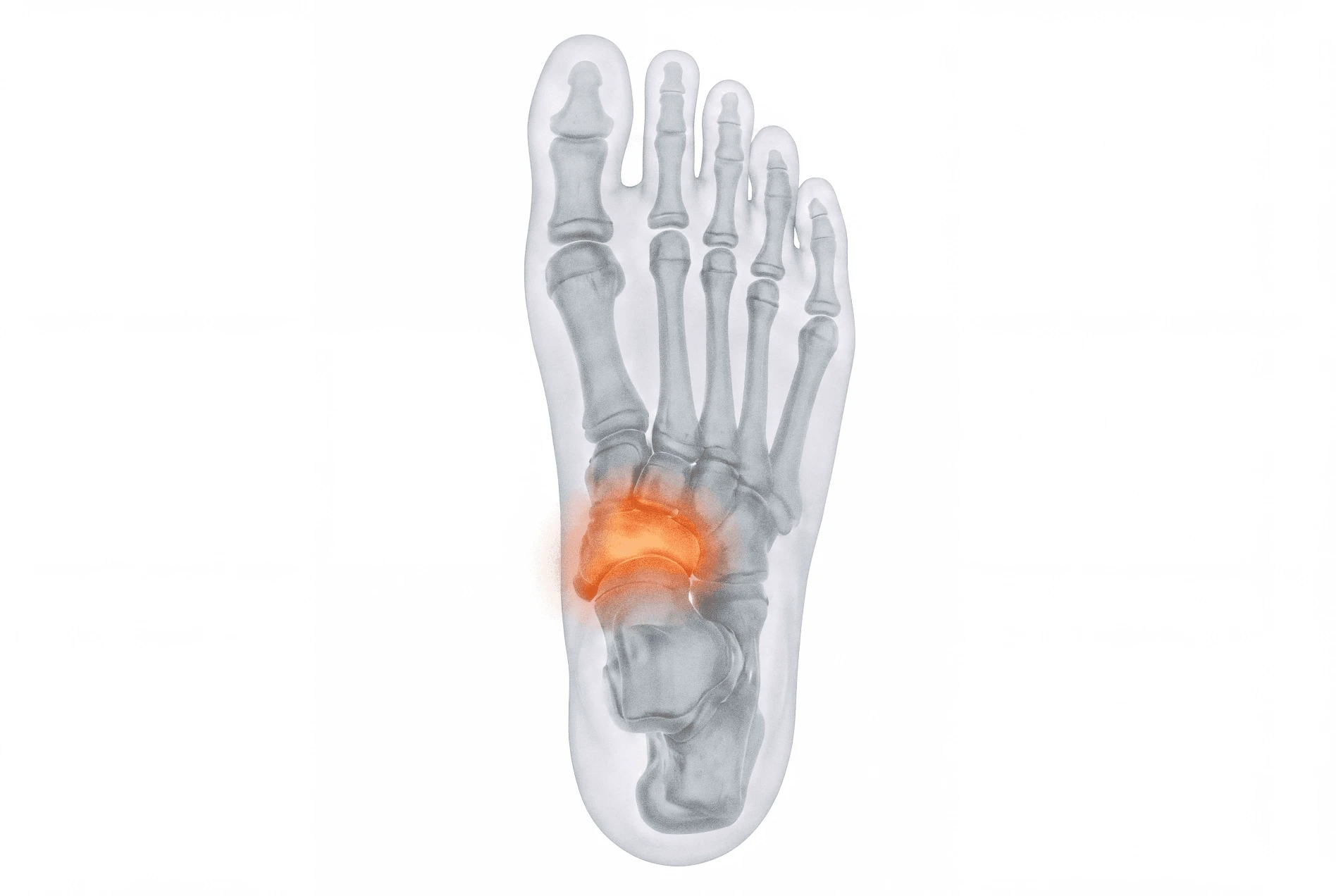 Child Accessory Navicular