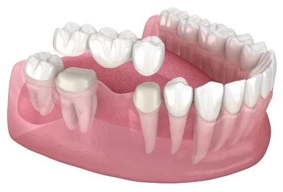 Understanding Sedation Dentistry