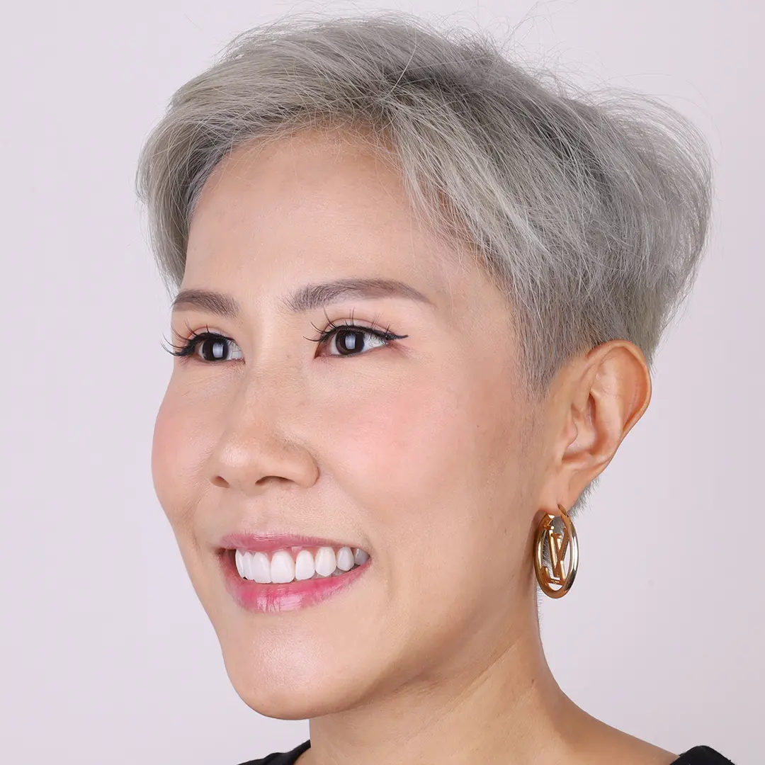 รีวิวออกแบบรอยยิ้มวีเนียร์ cosdent smile design