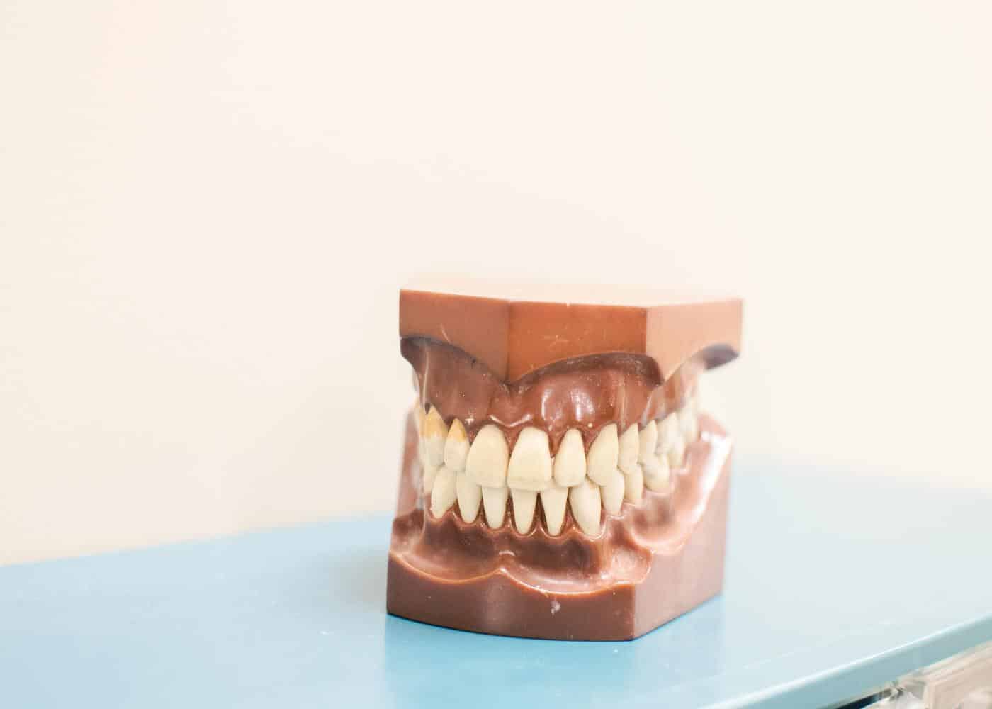 Supplements for healthy teeth & gums - Denstist model of teeth