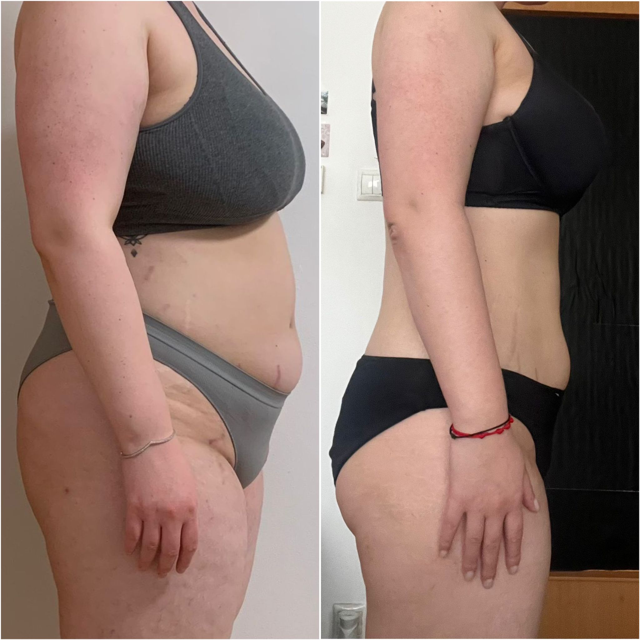 Transformation Photo