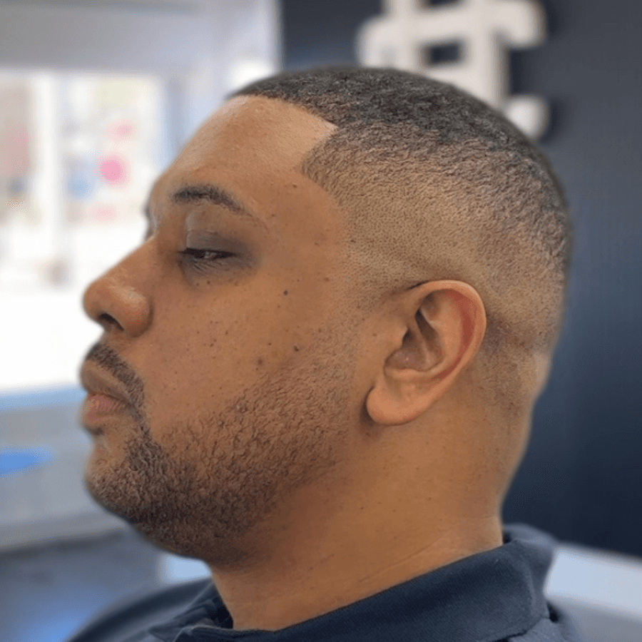 white rabbit on green grass during daytime