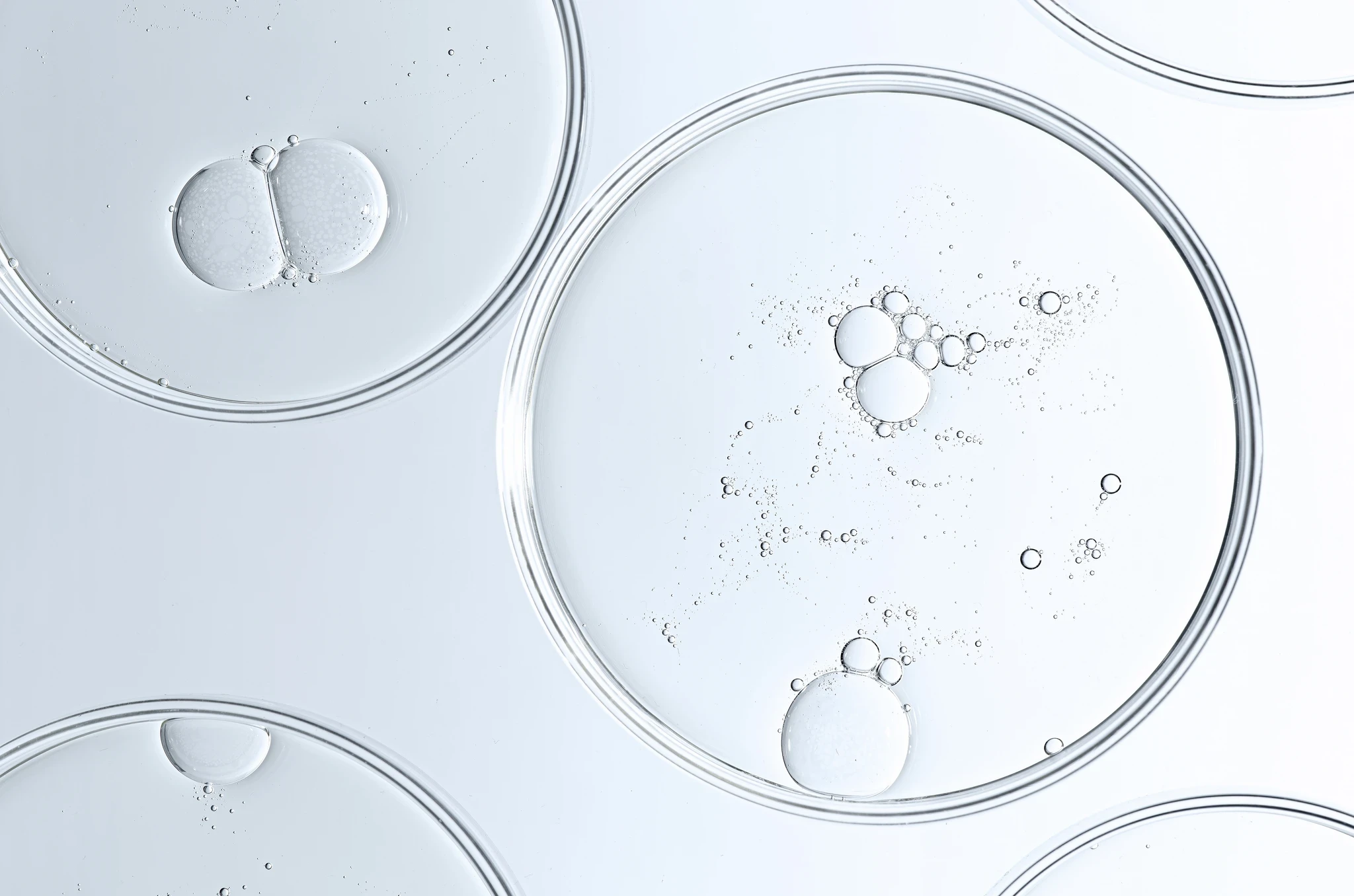 Several clear petri dishes containing droplets and bubbles of a clear liquid, viewed from above.
