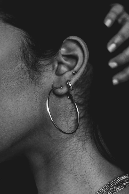 Otoplasty in Miami, FL