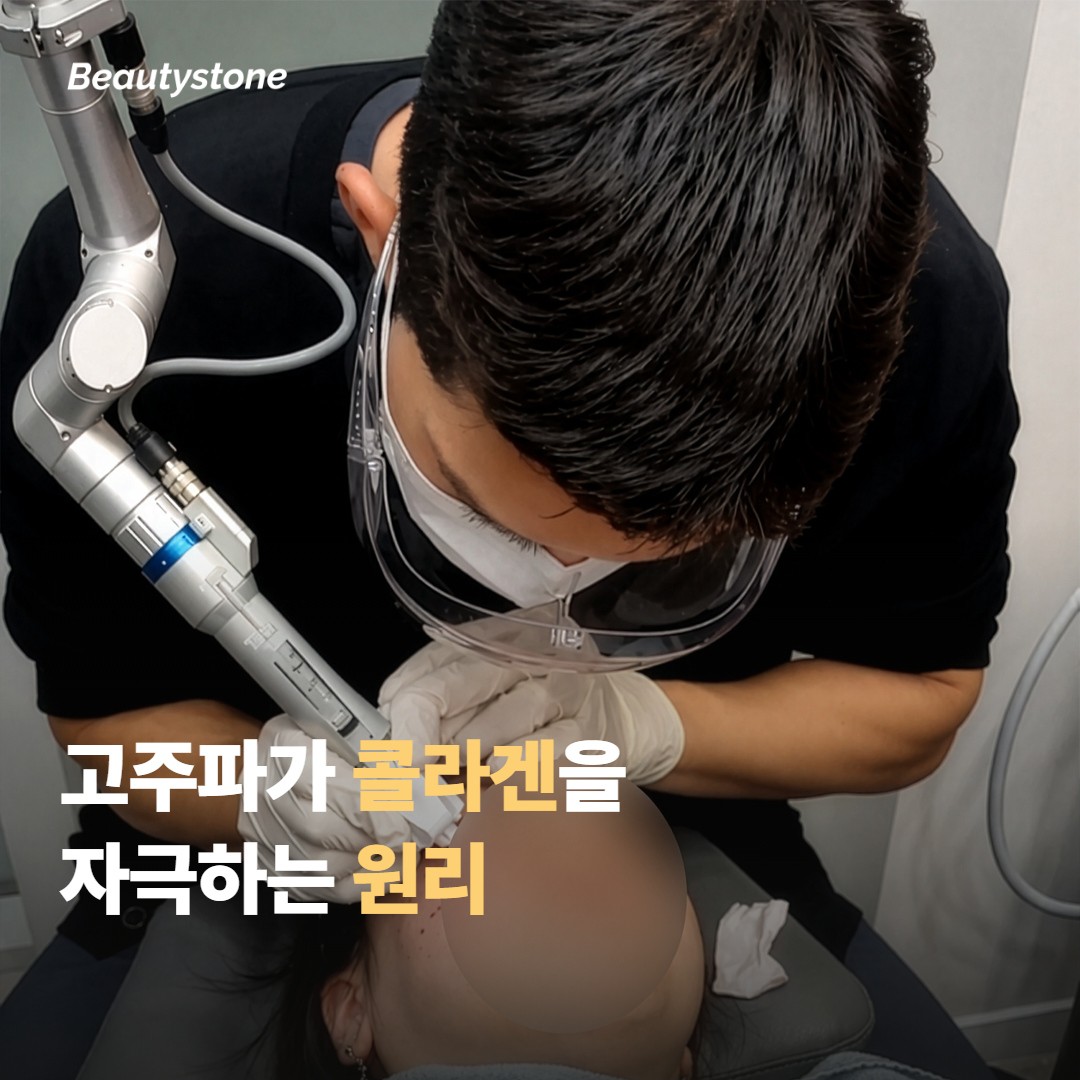 고주파 리프팅이 목 피부에 작용하는 원리
