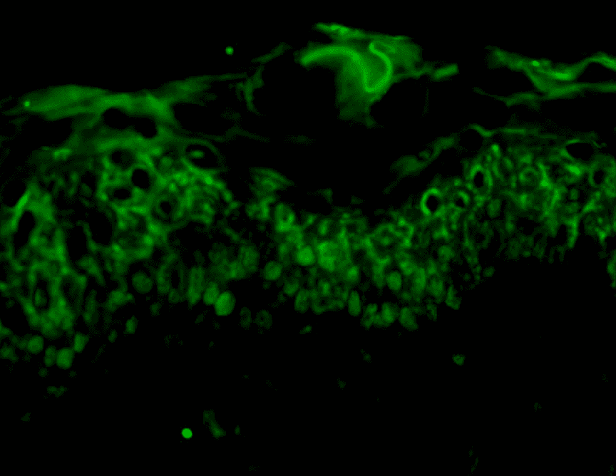 Antarka's enzyme