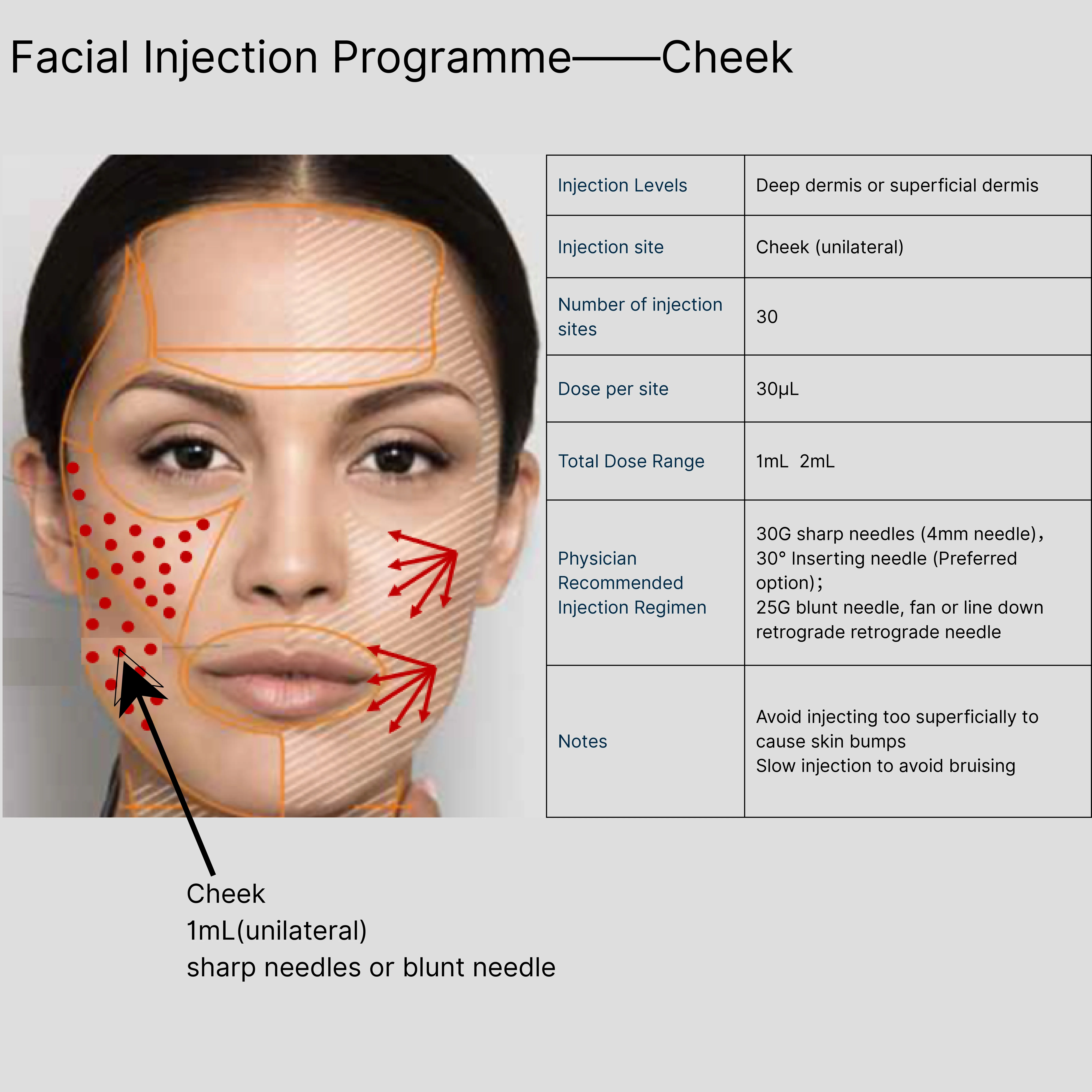 Aowita Hyaluronic Acid Manufacturer Facial Injection Programme——Cheek 