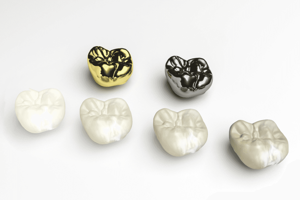 same day dental crowns