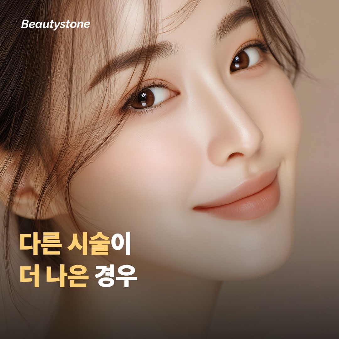 이런 경우엔 다른 시술이 더 나아요