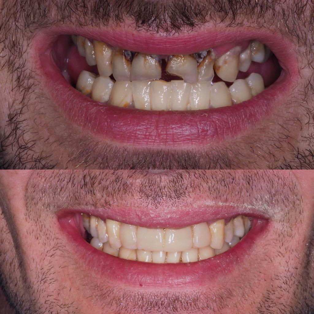 Before & After