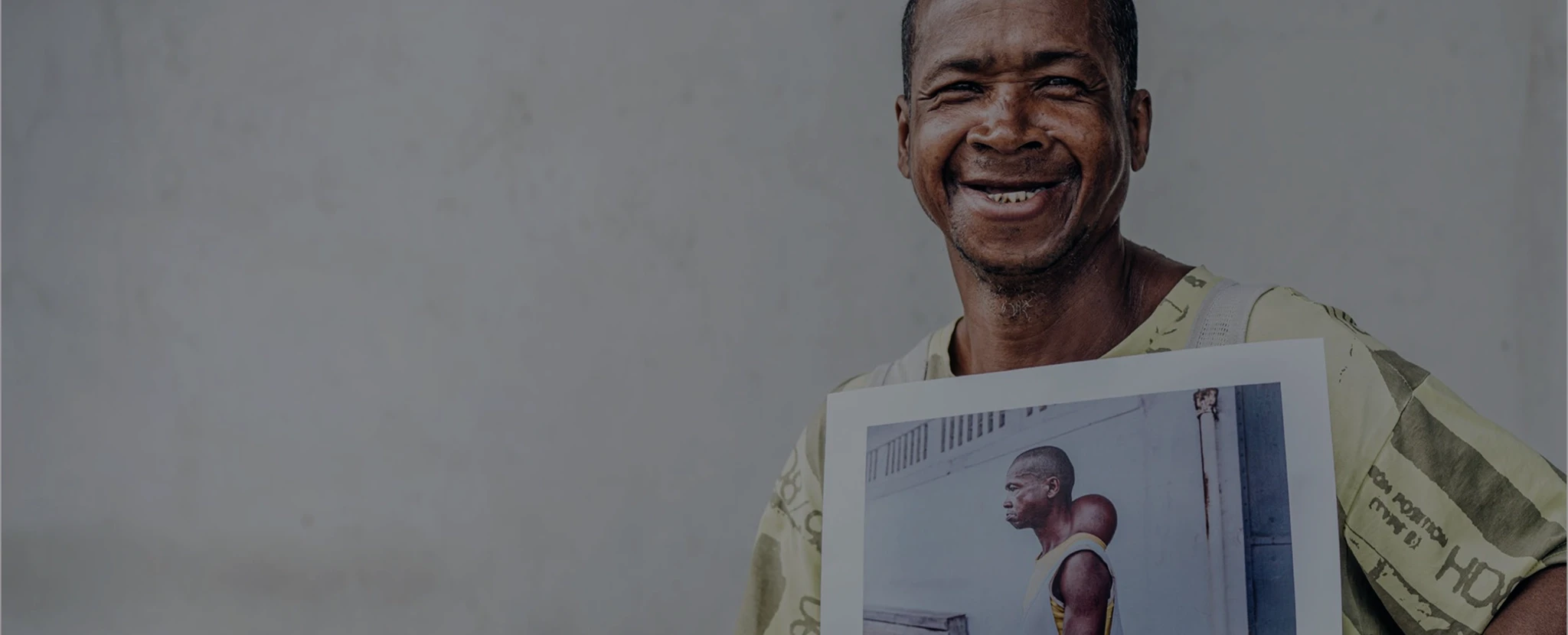 Man smiling and holding a photo of him before the surgery