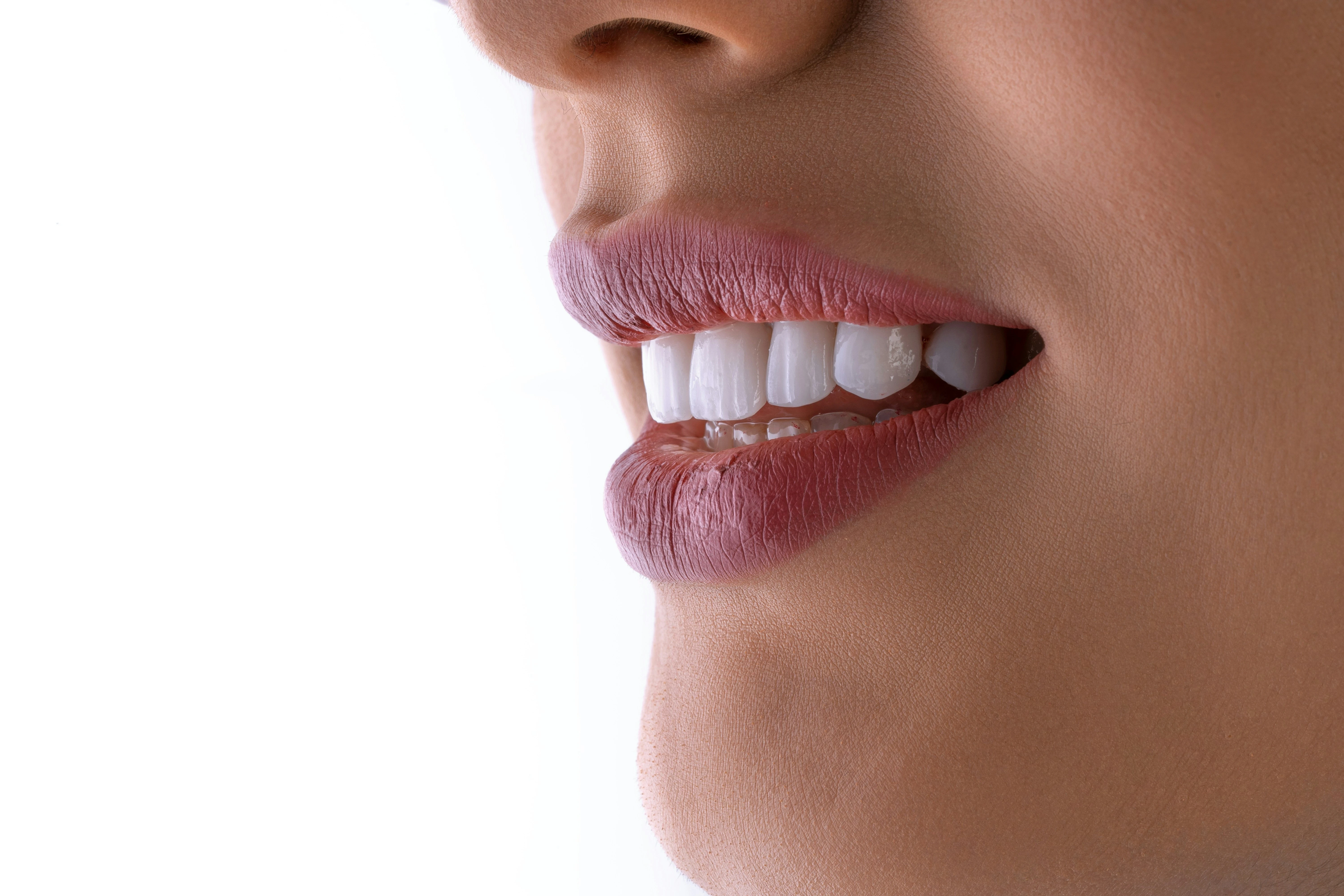 Flash White Laser Teeth Whitening in Bangkok COSDENT