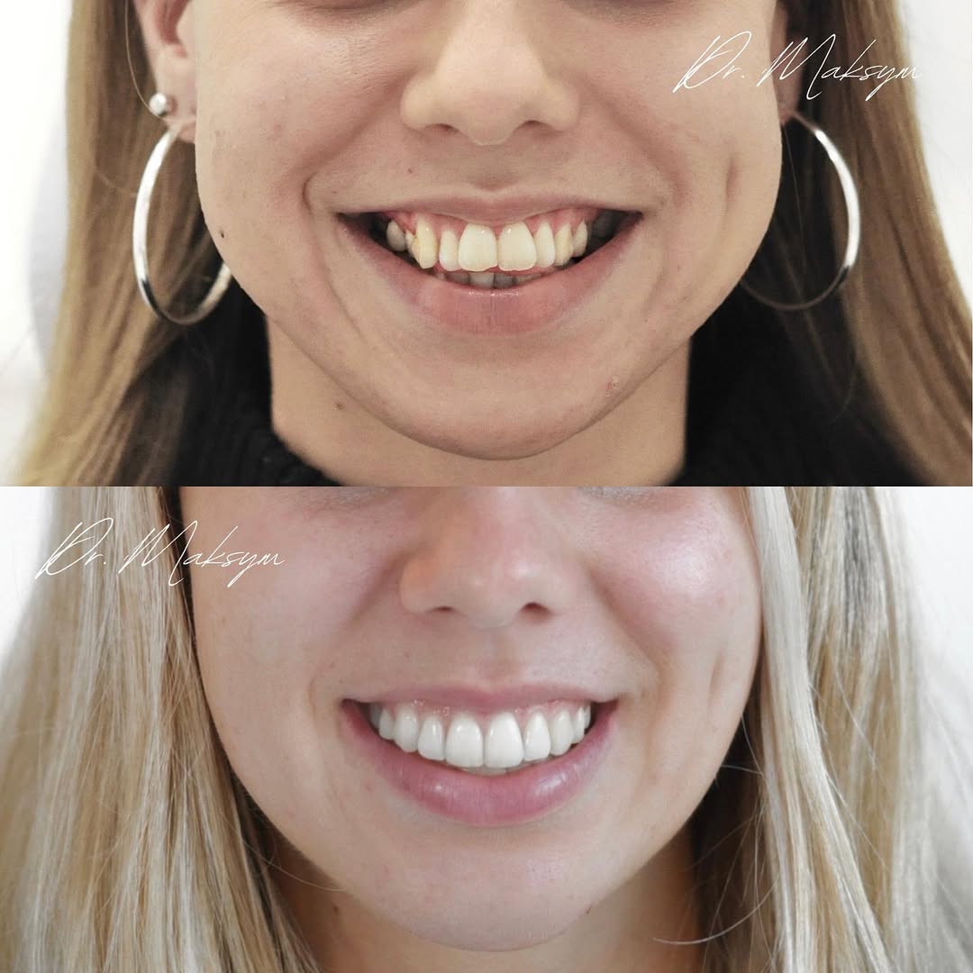 a dentist chair in a room with a painting on the wall