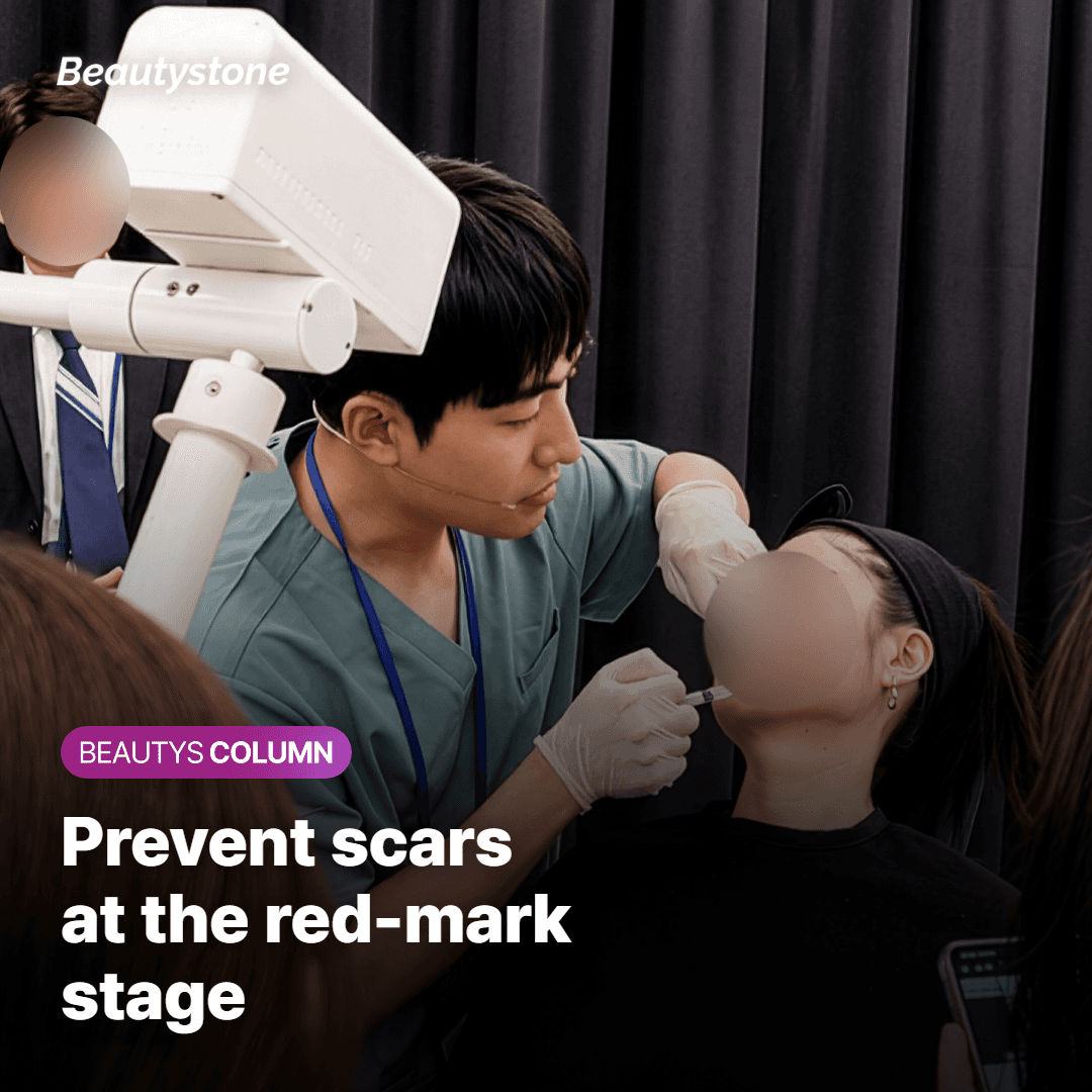 How to prevent acne scars with regenerative ointment care