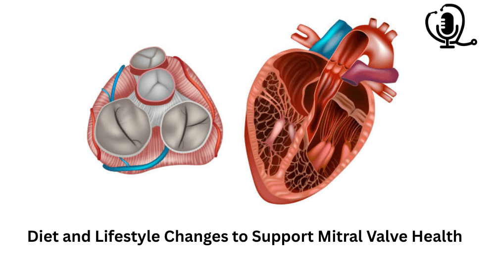 Diet and Lifestyle Changes to Support Mitral Valve Health