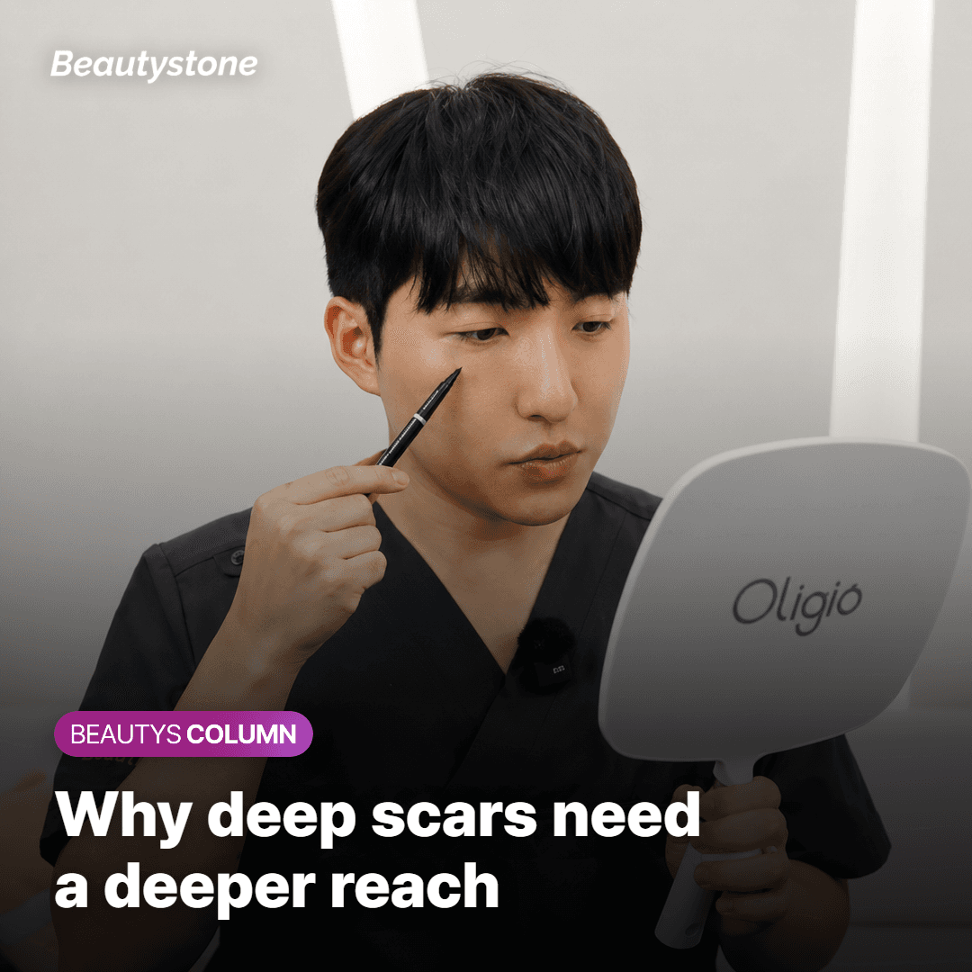 Why deep acne scars need microneedling to reach the lower dermis