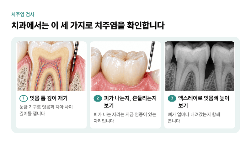눈금 기구로 잇몸 틈 깊이를 재고, 피가 나는지와 치아 흔들림을 보고, 엑스레이로 잇몸뼈 높이를 확인하는 치주염 검사 세 가지를 그린 일러스트