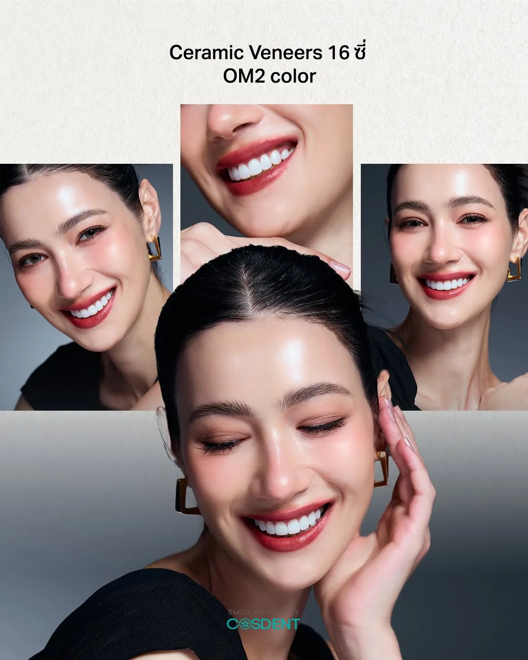 COSDENT smile collage, woman in black; label: 16 ceramic veneers, OM2.