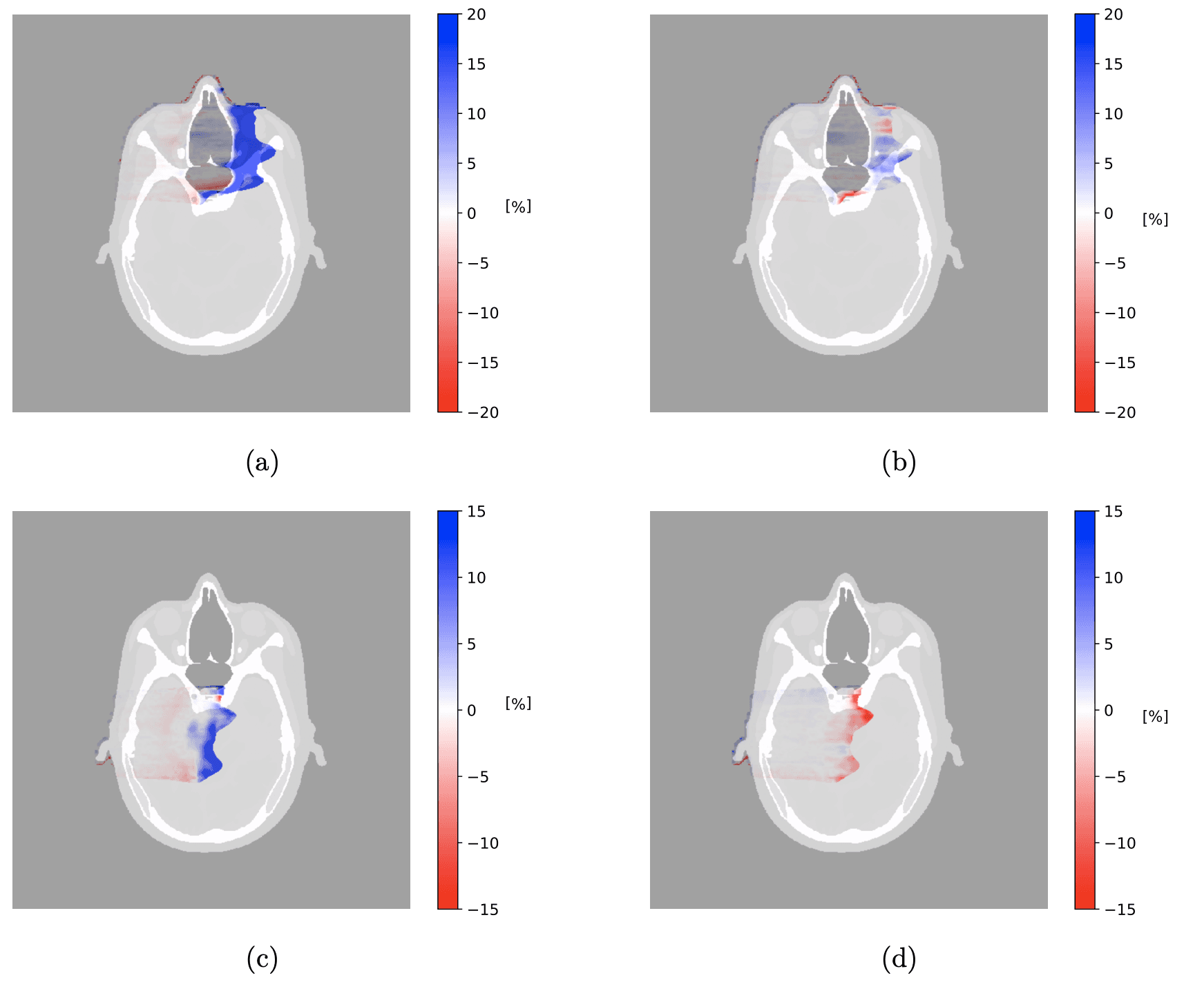 Difference in dose distribution between ground-truth plan and recalculated single-energy photon-counting CT (SE-PCCT) plan for (a) nasal tumor CTV and (c) brain tumor CTV, and ground-truth plan and recalculated PCCT plan for (b) nasal tumor CTV and (d) brain tumor CTV. The scale bar shows percent differences.