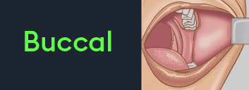 Illustration of the inside of a mouth labeled “Buccal.”