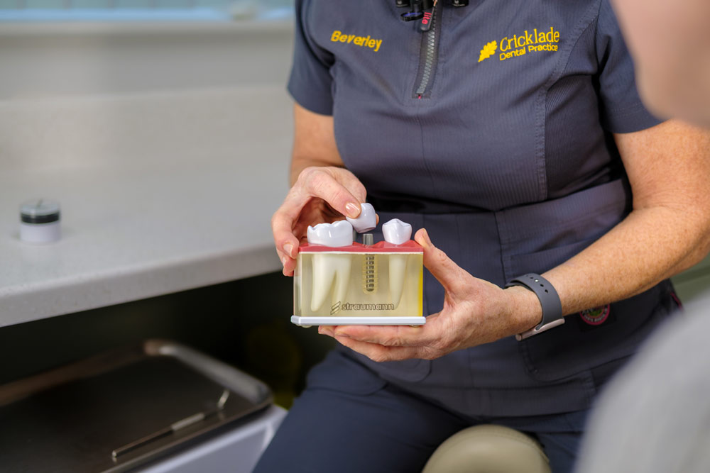 A close-up of Beverley, a Practice Owner, demonstrating a dental implant procedure using a clear Straumann jaw model. She is holding the model in one hand and positioning a dental crown over the implant fixture with the other. She is wearing a dark grey scrub top with "Cricklade Dental Practice" embroidered on the left.