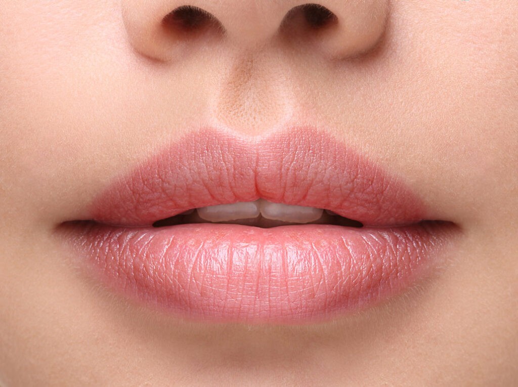 Dark Lip Correction