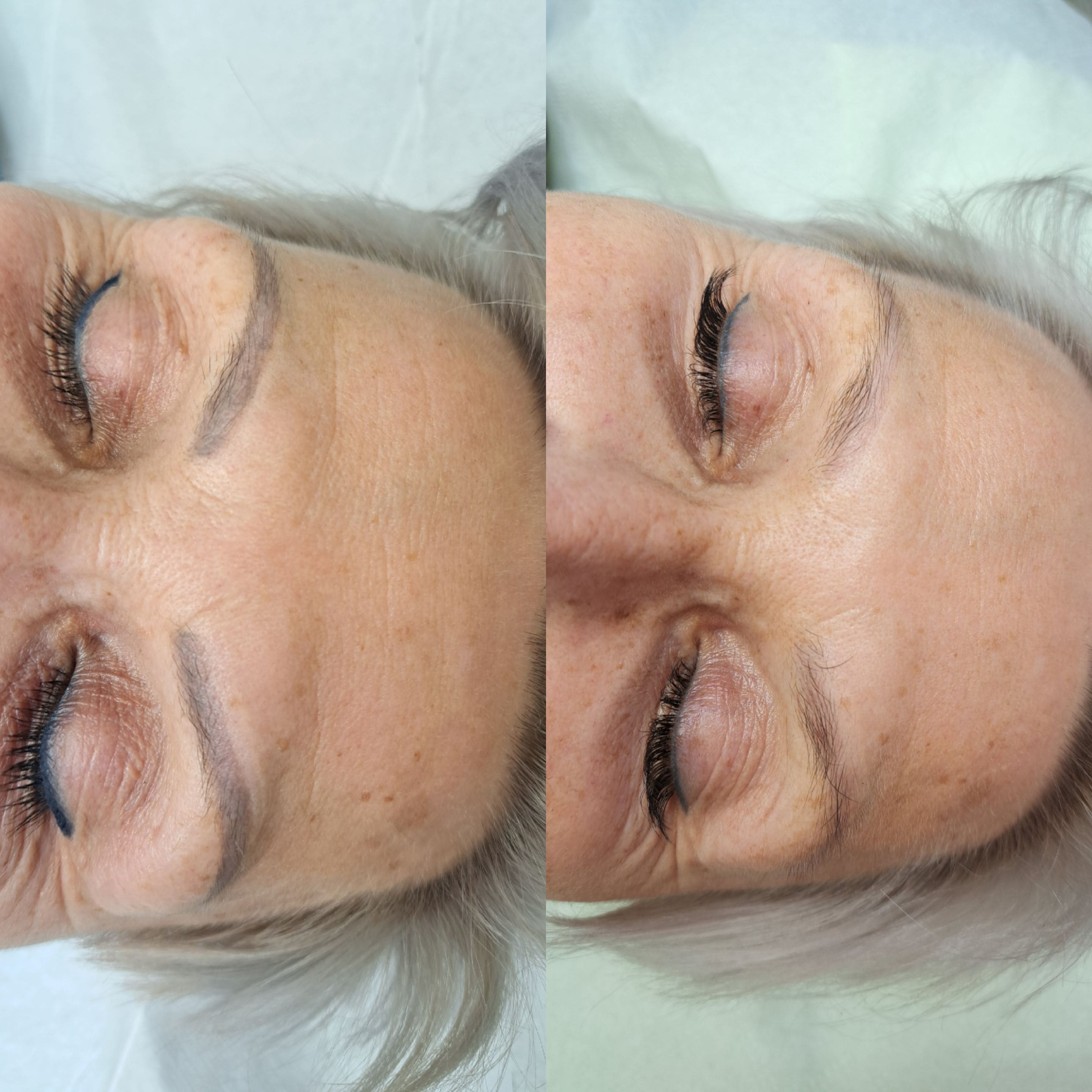 Neutralizacja usuwanie_makijazÌu_permanentnrgo_szczecin_leszczenko_pmu_laserowe