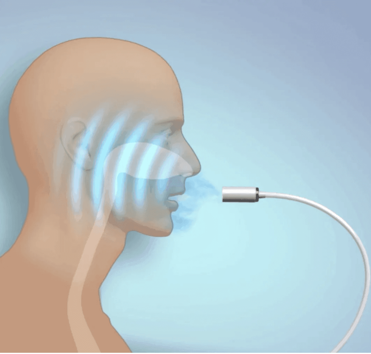 NanoVi Pro