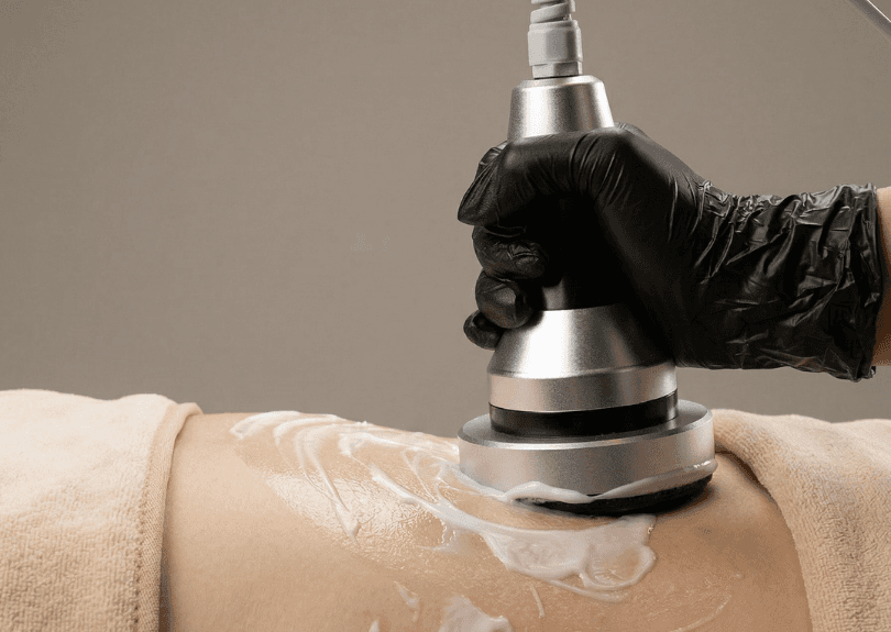 Woman receiving cosmetic skin treatment