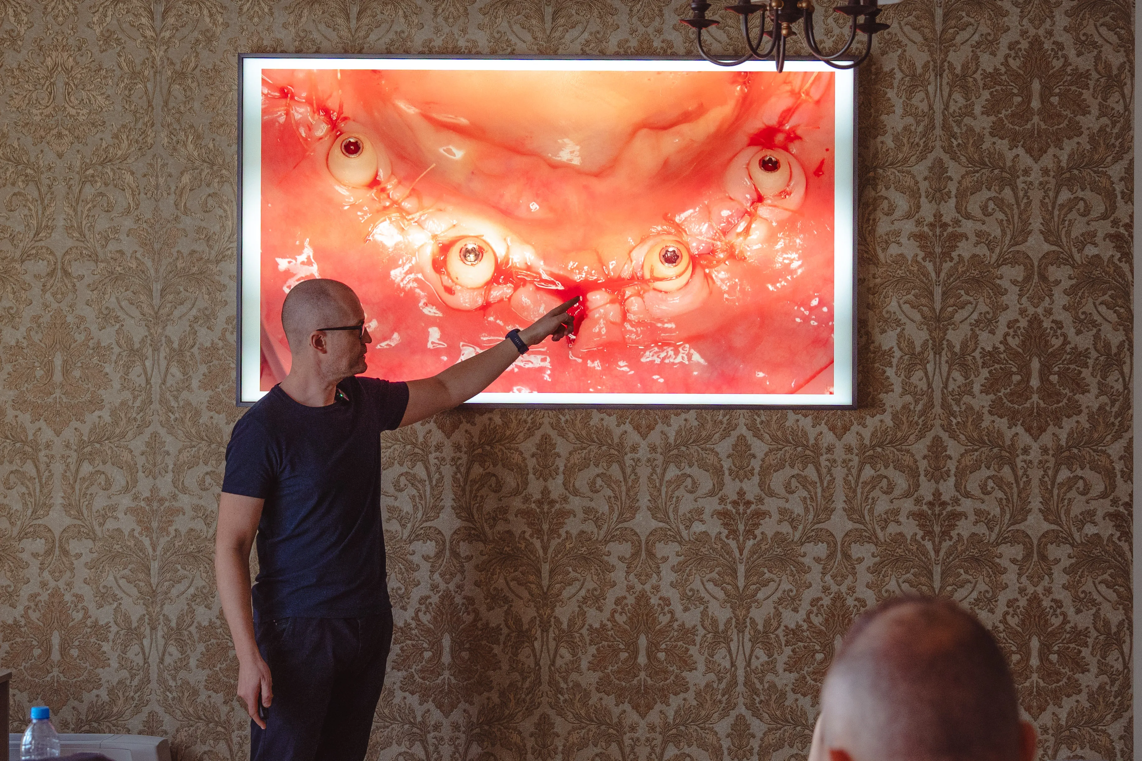 Fogászati Képzések - Kivehető protézistől a fix pótlásig - PraxEvents