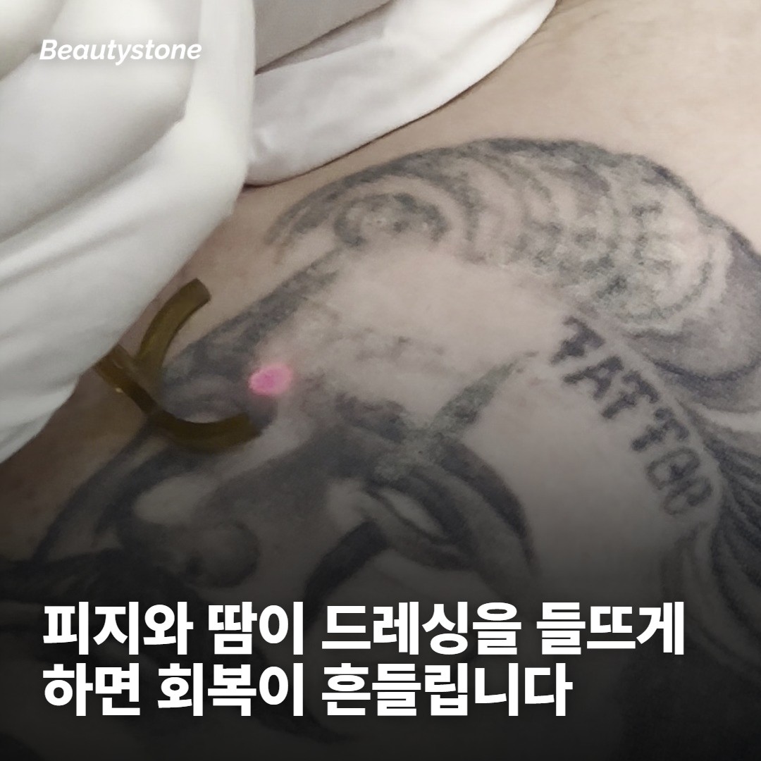 피지와 땀 — 회복기가 흔들리는 자리는 여기입니다