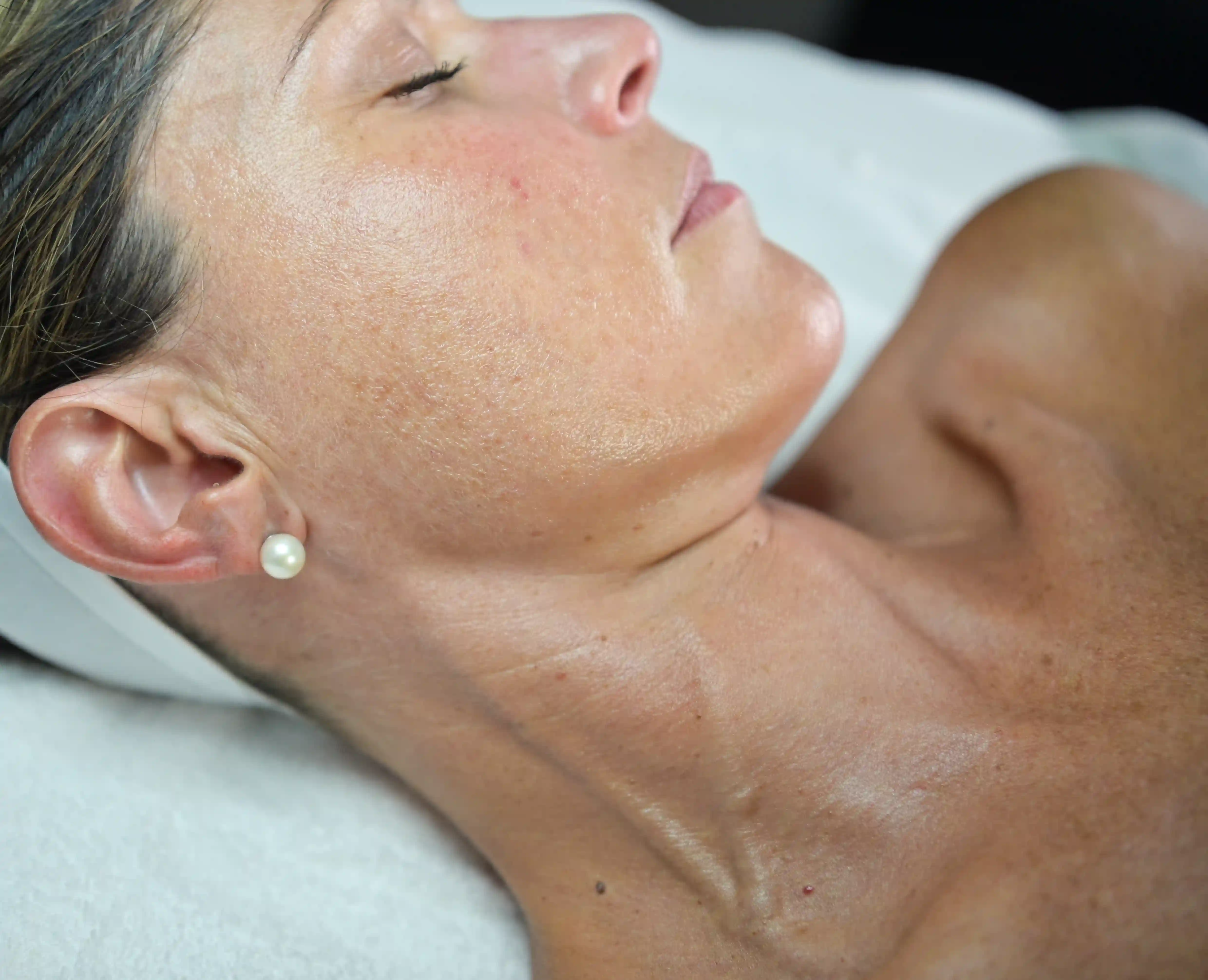 Marissa performing Peel Facial Service