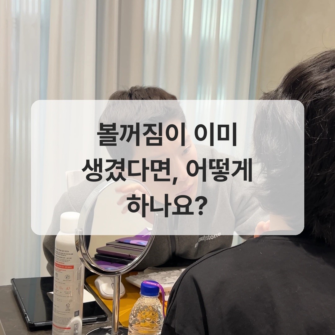 턱보톡스 볼꺼짐 해결 필러 보완 사례 이미지