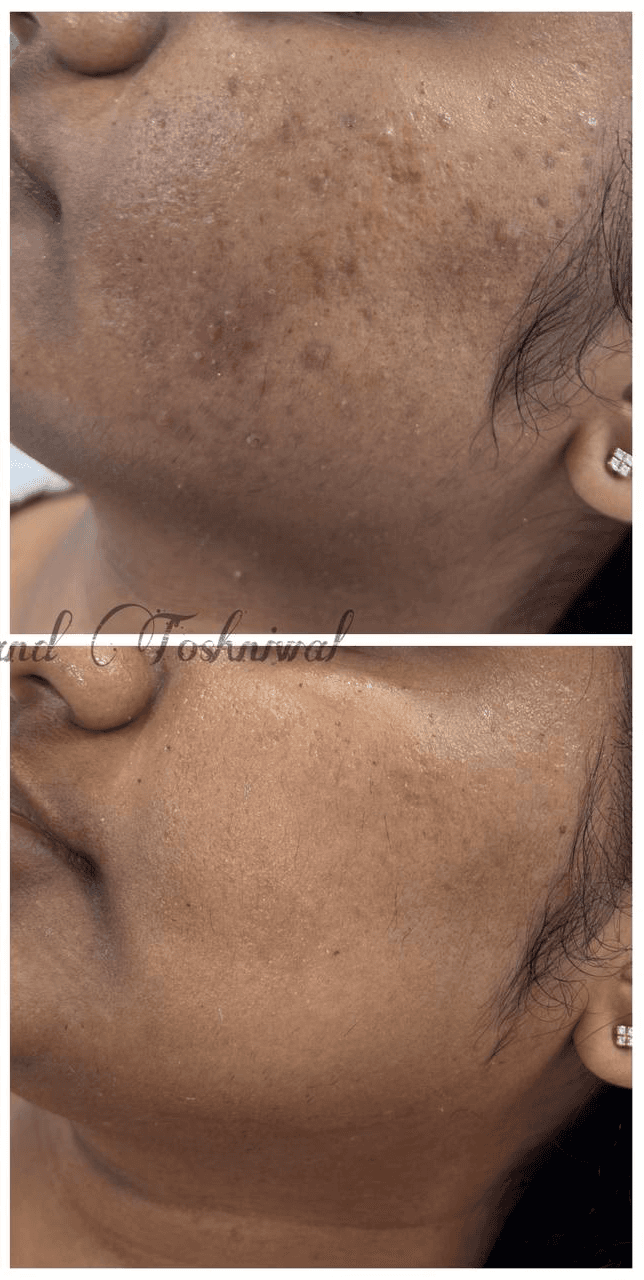 Woman applying facial serum with dropper. Skincare routine. Anti-aging product.