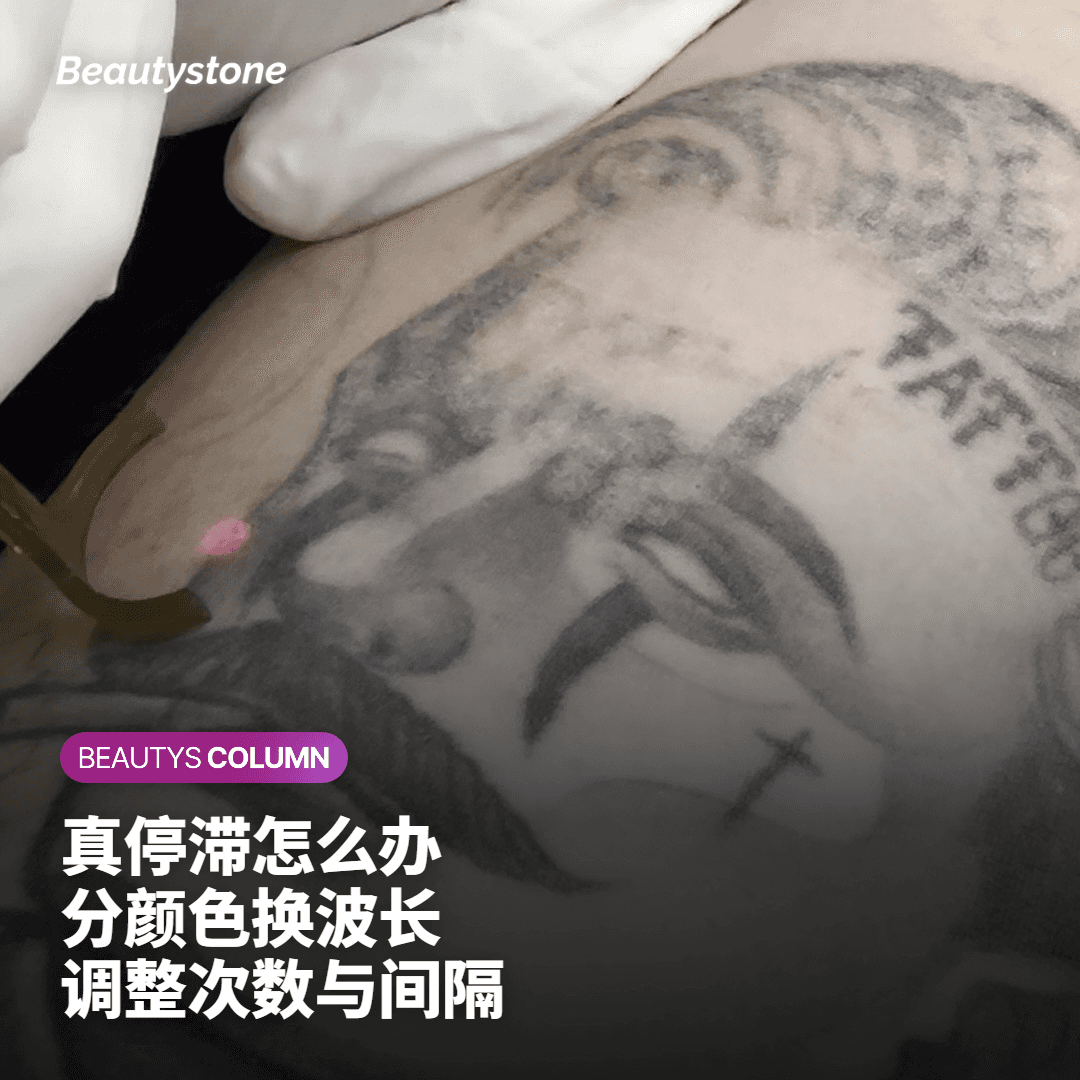 为什么选择合井 Beautystone