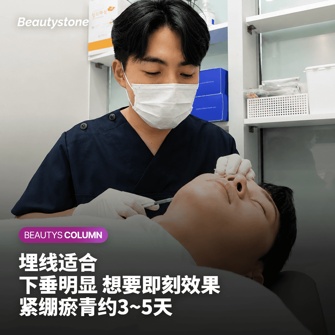 线雕提升适合哪类人群